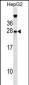 GFER Antibody (Center)